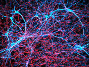 image of neurons