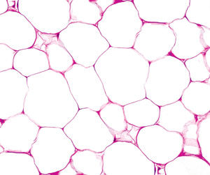image of immune cells in adipose tissue