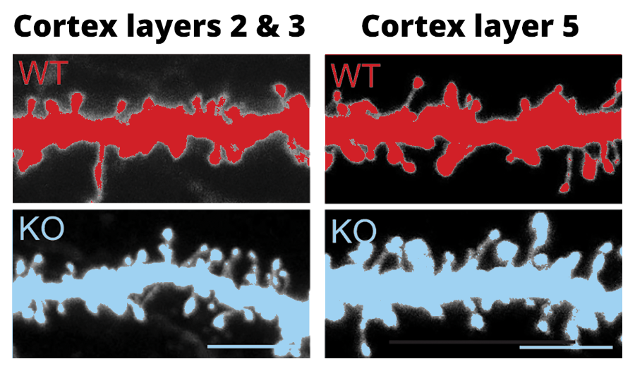 Images showing dendric spines of ortical neurons