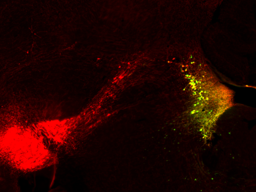 Norepinephrine in the brain