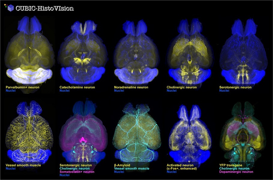 3D images of mouse brain