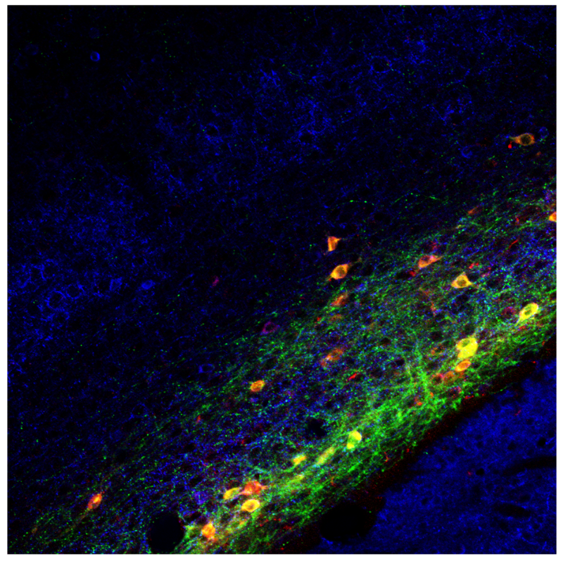 Image of claustrum neurons