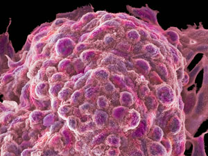 image of neurons image of cancer cells