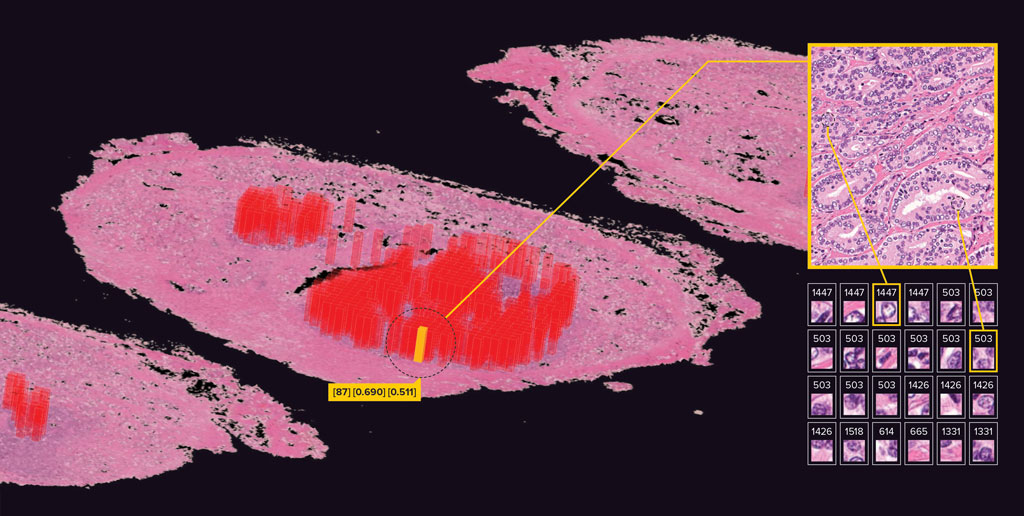image of regions of the brain image suggests recurrence of cancer