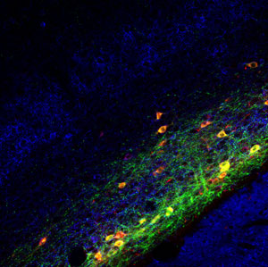 Microscopic image of claustrum neurons