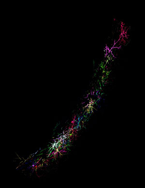 image of claustrum neuron2