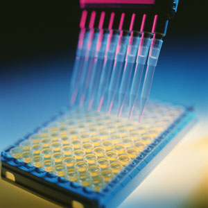 image of a conventional enzyme-linked immunosorbent assay 