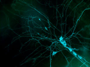 image of the dendrites of a fruit-fly neuron