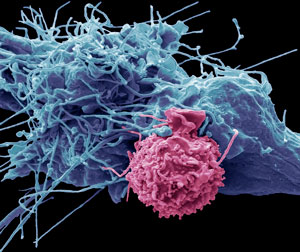 Image of a natural killer cell interacting with a cancer cell