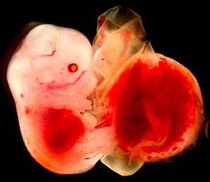 image of an embryo