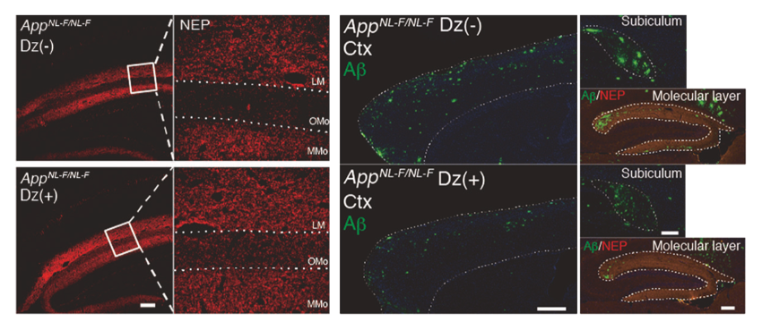 Image of hippocampus of Alzheimer’s disease model mice