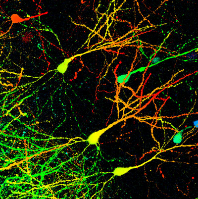 image of mouse neurons