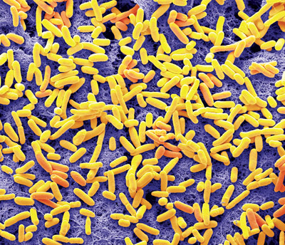 image of bacteria