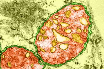 image of plant mitochondria