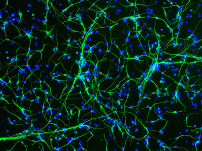 image of human hippocampus neurons