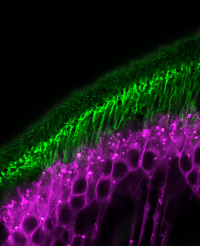 image of Dumpy filaments in cuticle and tendon in a fruit fly pupa.