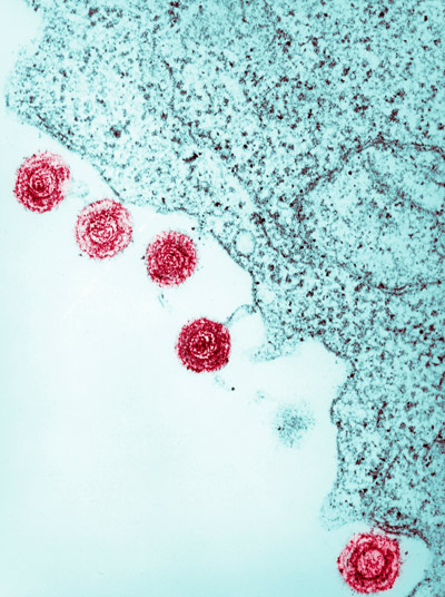 image of  human herpesviruses 6