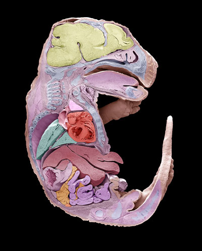 image of one half of mouse embryo