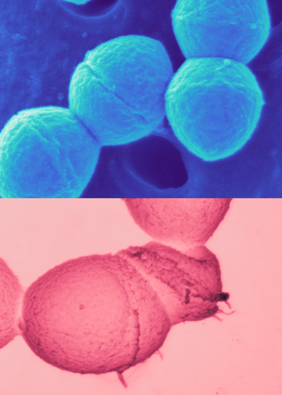 image of drug-resistant bacteria 