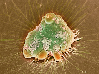 image of a cancer cell
