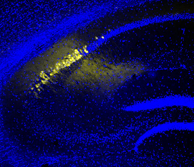 image of the CA2 region of the hippocampus