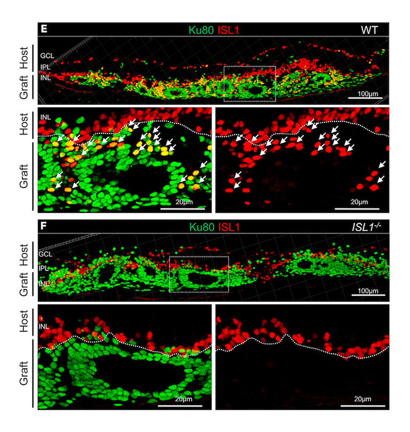 Image of retina after transplanting retinal sheets from normal or modified human stem cells