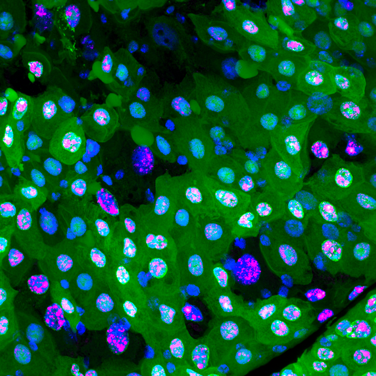 Image of gut cells during erebosis