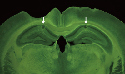 image of brain