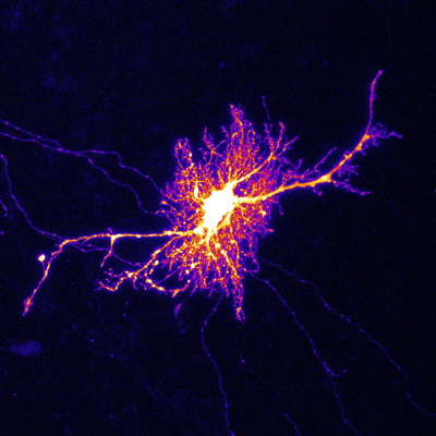 image of a labeled astrocyte