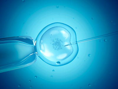 image of  in vitro fertilization