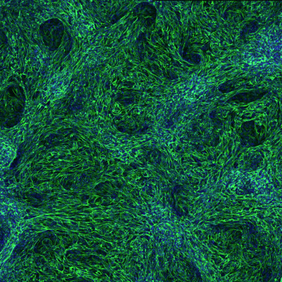 image of liver-specific mesenchymal tissue