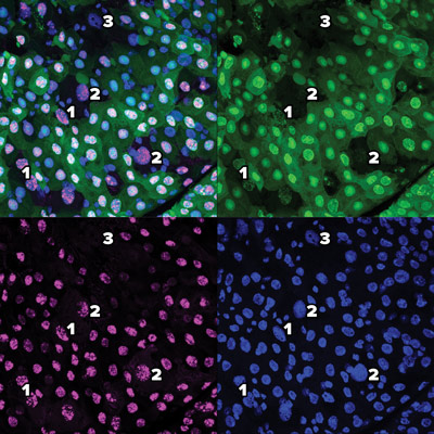 image of process of a new type of cell death dubbed erebosis