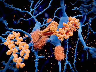 image of amyloid beta