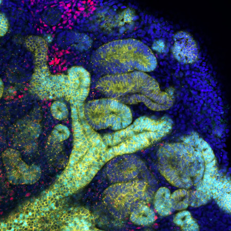 image of kidney organoids