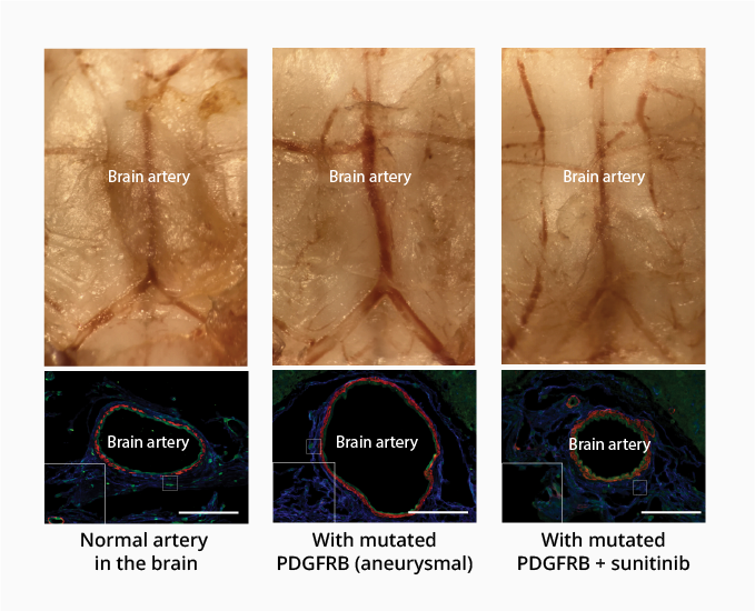 image of brain artery with or without drug treatment
