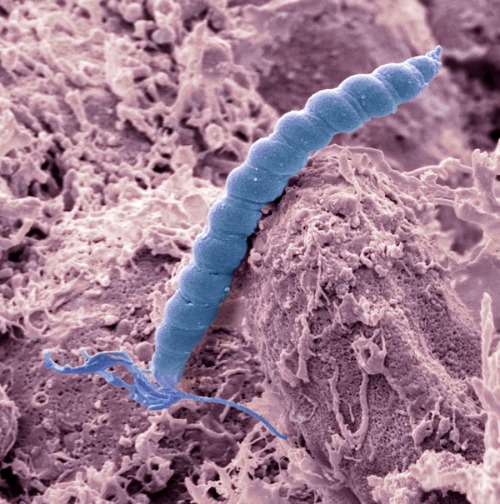 image of Helicobacter pylori