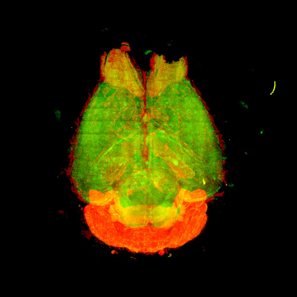 Image of a mouse brain