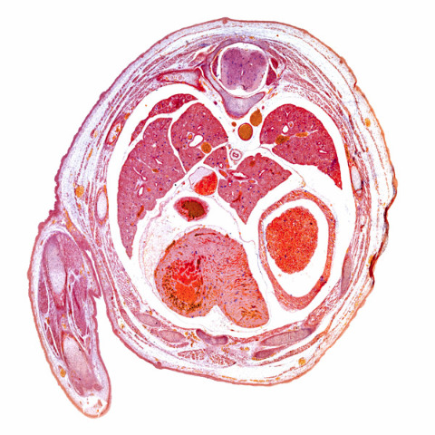 Image of the thorax of a mouse embryo