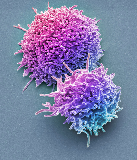 Image of two T cells
