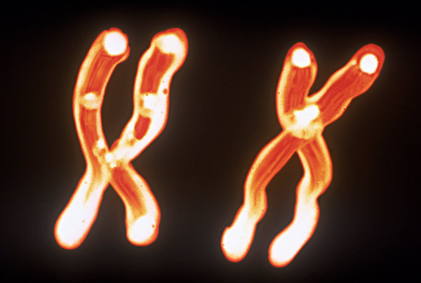 image of heterochromatin